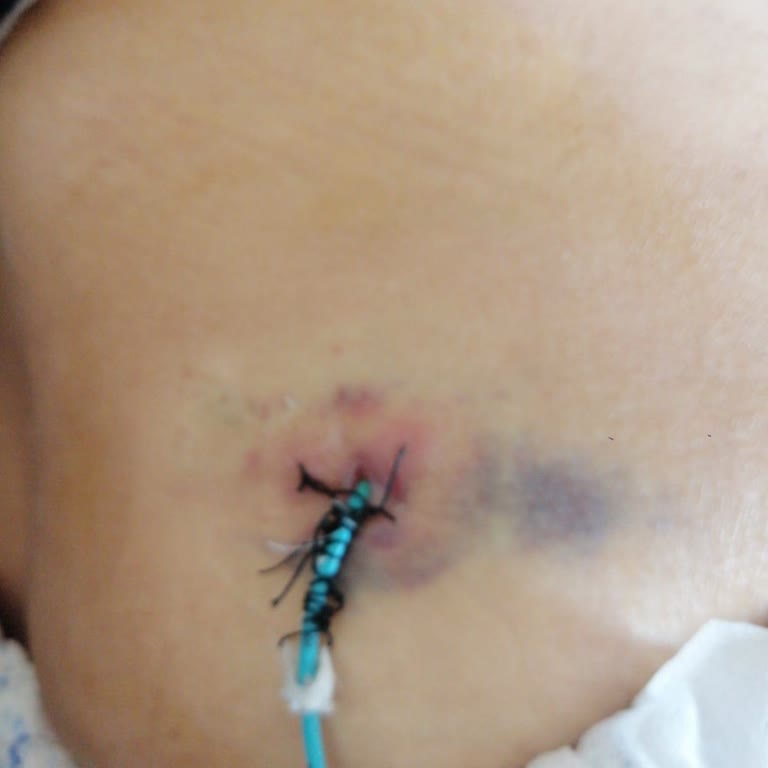 Annemi Tedavisiz Bırakıp Böbrek Sağlığını Riske Atıyorlar