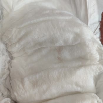 Bebek Bezi Üzerindeki Leke Sağlık Endişesi Yarattı