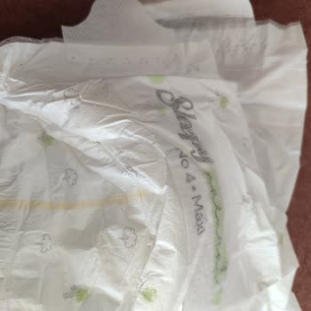 Bebek Bezi Üzerindeki Leke Sağlık Endişesi Yarattı