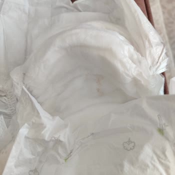 Bebek Bezi Üzerindeki Leke Sağlık Endişesi Yarattı