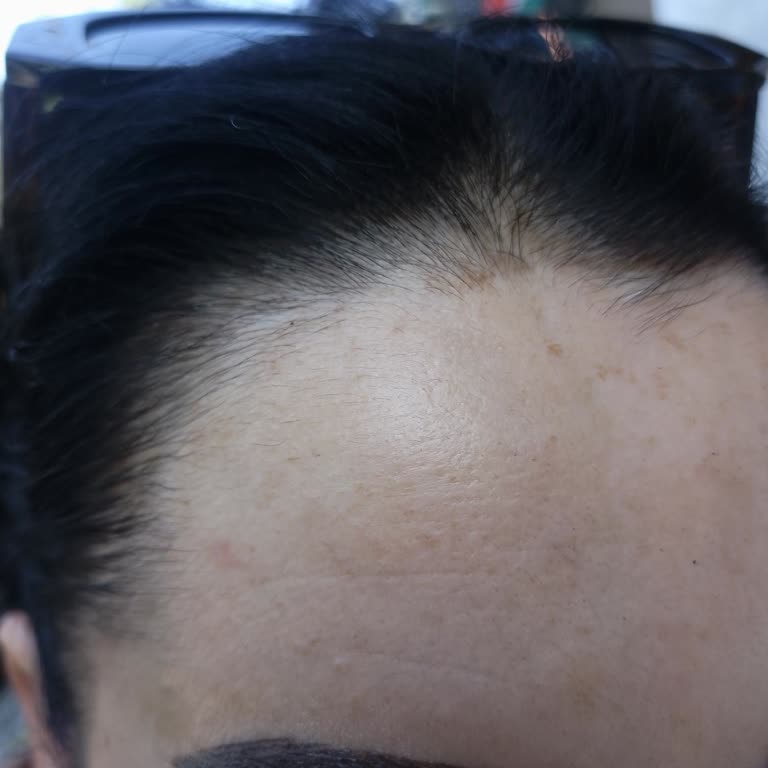 Microblading İşleminde Eksik Bilgilendirme Ve Ekstra Ücret Talebi