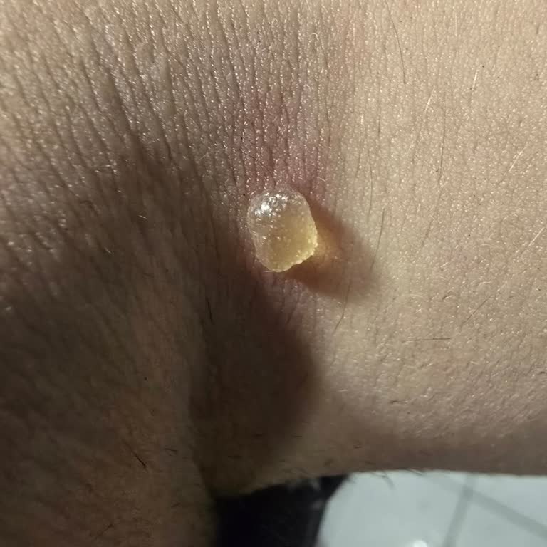 İlk Kullanımda Ciddi Cilt Reaksiyonu Ve Güven Kaybı