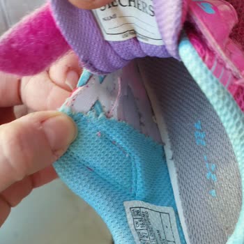 Skechers Ayakkabı Çocuğumun Ayağını Yaraladı