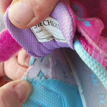 Skechers Ayakkabı Çocuğumun Ayağını Yaraladı
