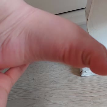 Skechers Ayakkabı Çocuğumun Ayağını Yaraladı