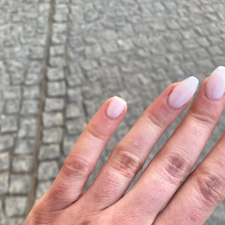 Kırılan Tırnak Ve İlgisiz Müşteri Hizmeti Nedeniyle Hayal Kırıklığı