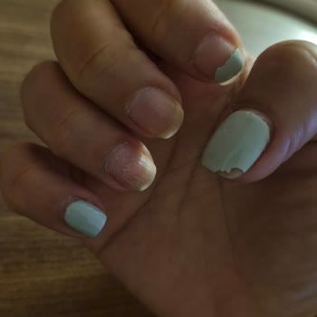 Kalıcı Oje Uygulaması Bir Haftada Soyuldu, Şikayetim Çözümsüz Kaldı