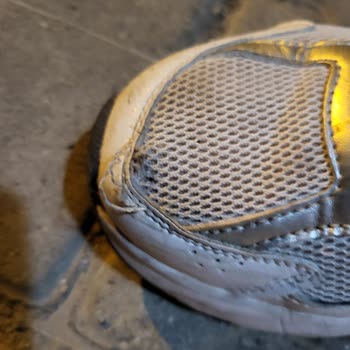 Kısa Sürede Sökülen Dikişler Ve Garanti Sorunu Yaşadık