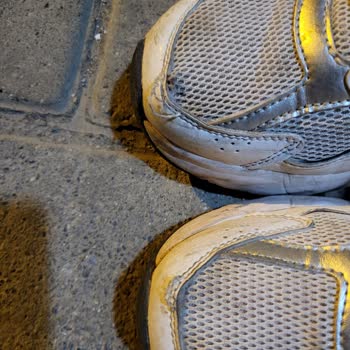 Kısa Sürede Sökülen Dikişler Ve Garanti Sorunu Yaşadık