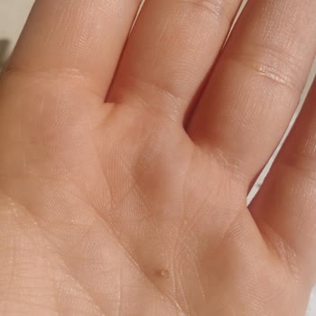 Migros’tan Alınan Chia Tohumunda Sağlık Tehlikesi Ve Yabancı Maddeler