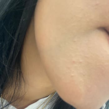 Serum Paketi Sonrası Cildimde Olumsuz Reaksiyonlar Oluştu