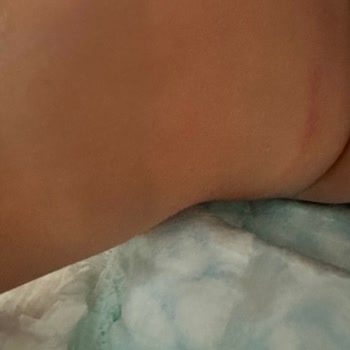 Molfix Premium Bezde Pisik Önleyici Özellik Çalışmıyor