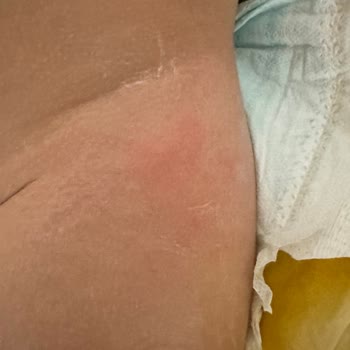 Molfix Premium Bezde Pisik Önleyici Özellik Çalışmıyor