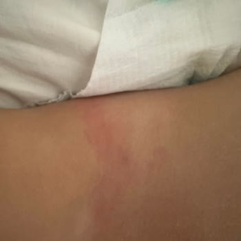 Molfix Premium Bezde Pisik Önleyici Özellik Çalışmıyor