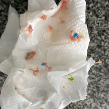 Kıymadan Plastik Eldiven Ve Poşet Parçası Çıktı, Hijyen Sorunu Yaşadım