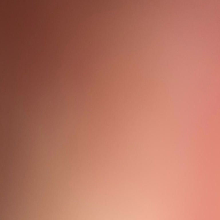 Renault Clio'da Kronik Devirdaim Pompası Sorunu Ve Yüksek Değişim Ücreti