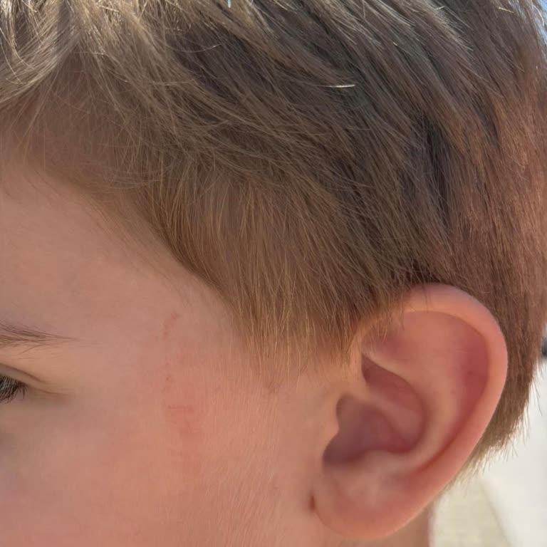 Anaokulunda İhmal: Oğlumun Güvenliği Ve Psikolojisi Tehlikeye Atıldı