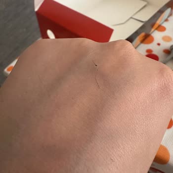 Siparişimde Eksik Ürün Ve Hijyen Sorunu Yaşadım