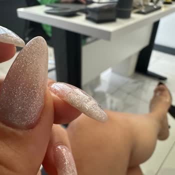 Oje Spa İlgisizliği Ve Başarısız İşlemler
