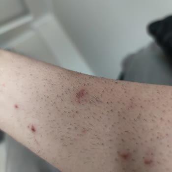 Ek Ücretler Ve Uygunsuz İthamlarla Mağduriyet Yaşadım, Kollarım Da Zarar Gördü