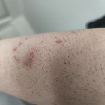 Ek Ücretler Ve Uygunsuz İthamlarla Mağduriyet Yaşadım, Kollarım Da Zarar Gördü