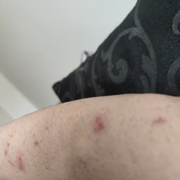 Ek Ücretler Ve Uygunsuz İthamlarla Mağduriyet Yaşadım, Kollarım Da Zarar Gördü