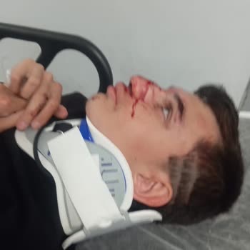 Çorum Kale Özel Eğitim Uygulama Okulu Kamera Kayıtlarını İzletmiyorlar, Bozuk Diyorlar!