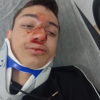 Çorum Kale Özel Eğitim Uygulama Okulu Kamera Kayıtlarını İzletmiyorlar, Bozuk Diyorlar!