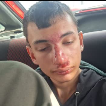 Çorum Kale Özel Eğitim Uygulama Okulu Kamera Kayıtlarını İzletmiyorlar, Bozuk Diyorlar!