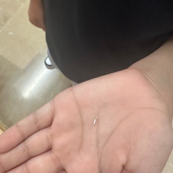 Dondurmadan Çıkan Metal Parçaları Boğazıma Battı