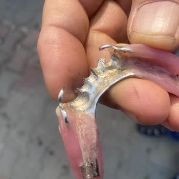 Devlet Hastanesinde Diş Protezinde Hata Ve İlgisizlik