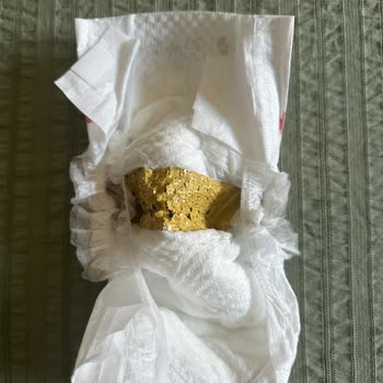 Bebek Bezinde Yabancı Madde Endişesi