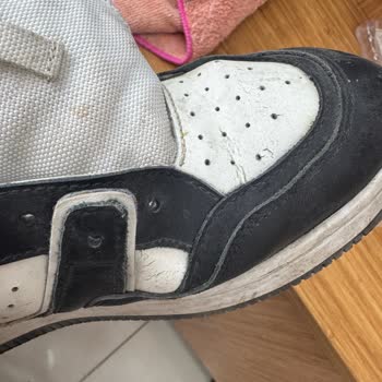 Yeni Alınan Ayakkabıda Beklenmedik Deformasyon Ve Garanti Reddi