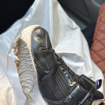 Çocuğumun Sağlığını Tehlikeye Atan Ayakkabı Ve Civil Mağazasının İlgisizliği