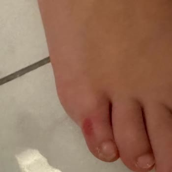 Çocuğumun Sağlığını Tehlikeye Atan Ayakkabı Ve Civil Mağazasının İlgisizliği