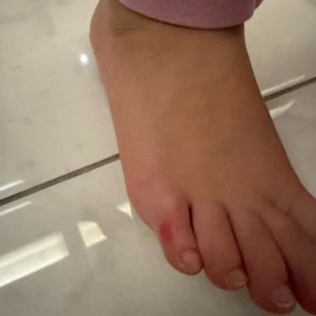 Çocuğumun Sağlığını Tehlikeye Atan Ayakkabı Ve Civil Mağazasının İlgisizliği