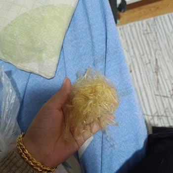 Şampuan Ve Saç Spreyi Kullanımı Sonrası Saç Dökülmesi Ve Psikolojik Etkileri