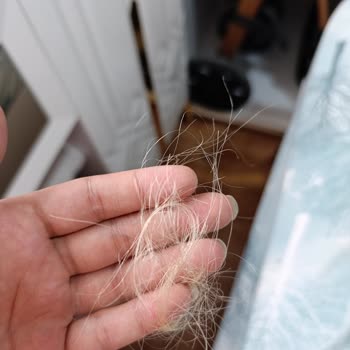 Şampuan Ve Saç Spreyi Kullanımı Sonrası Saç Dökülmesi Ve Psikolojik Etkileri