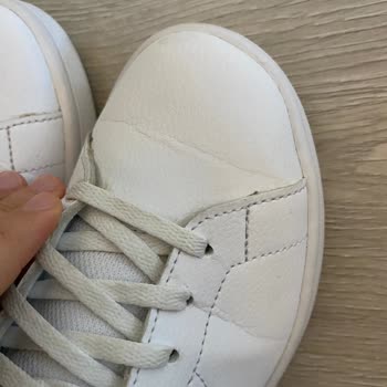 1 Saatte Çatlayan Adidas Ayakkabı Hayal Kırıklığı