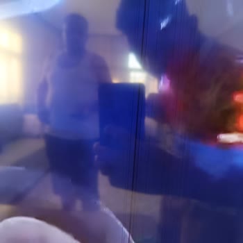 Garanti Kapsamındaki Toshiba TV'de Ekran Arızası Ve Haksız Servis Raporu