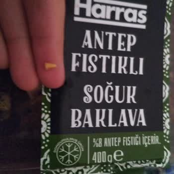 Aldığım Üründen Çıkan Sert Yabancı Maddeyle Yaşadığım Şok