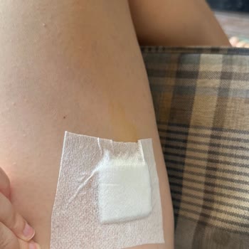 Baydöner Midtown Şubesinde İskender Tabağı Parçası İle Yaralanma Ve İlgisizlik