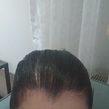 Saç Boyası Sonucu Beklenen Renkte Olmadı, Saçlarım Siyaha Döndü