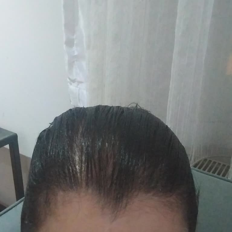 Saç Boyası Sonucu Beklenen Renkte Olmadı, Saçlarım Siyaha Döndü