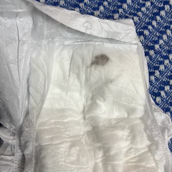 Bebek Bezinde Leke Ve Böcek Ölüsü Hijyen Şüphesi Yaşadım