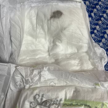 Bebek Bezinde Leke Ve Böcek Ölüsü Hijyen Şüphesi Yaşadım