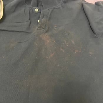 Vanish Oxi Action Tişörtlerimi Mahvetti, Zararım Karşılanmalı!