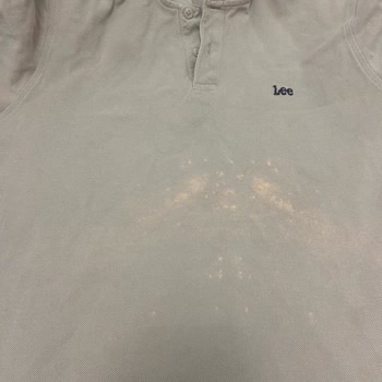 Vanish Oxi Action Tişörtlerimi Mahvetti, Zararım Karşılanmalı!