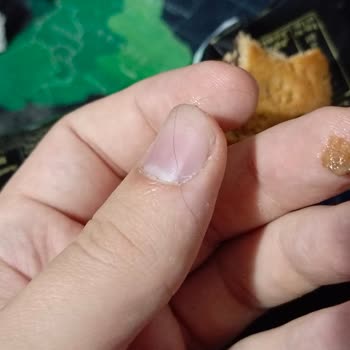 Biskrem Extra Ürününde Yabancı Madde Şoku: Tüy Ve Kıl Parçaları