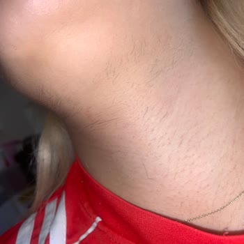 Seans Sonrası Randevu Verilmedi Ve İstenen Sonuç Alınmadı